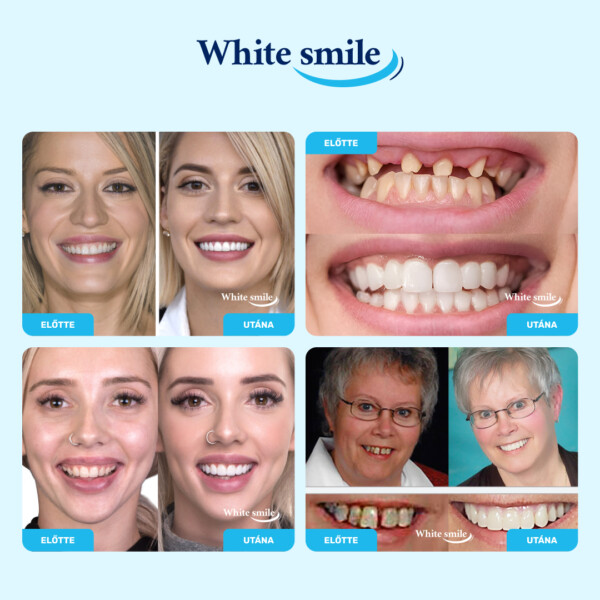 Valósághű műfogak: WhiteSmile - Image 2
