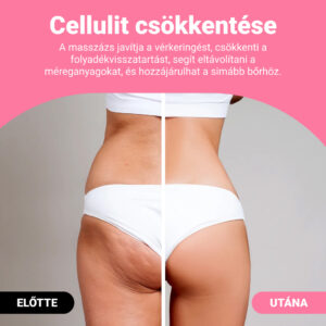 Alternative view of Guasha™ – Természetes Gua Sha Masszázs Henger