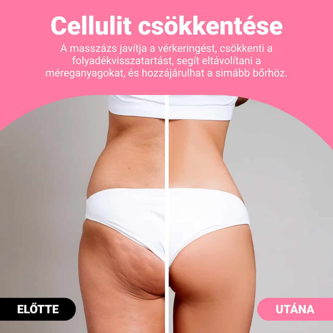 GUASHA – testformáló masszázshenger a cellulit és zsír látható csökkentésére - Image 2