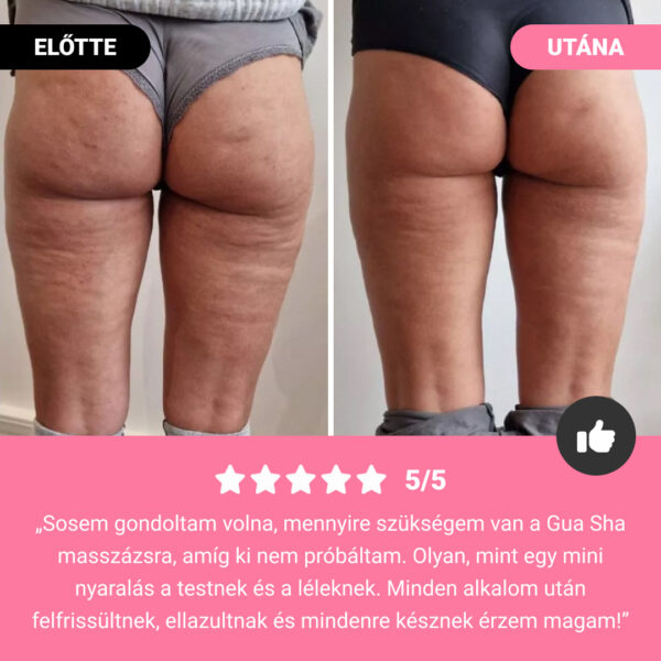 GUASHA – testformáló masszázshenger a cellulit és zsír látható csökkentésére - Image 7